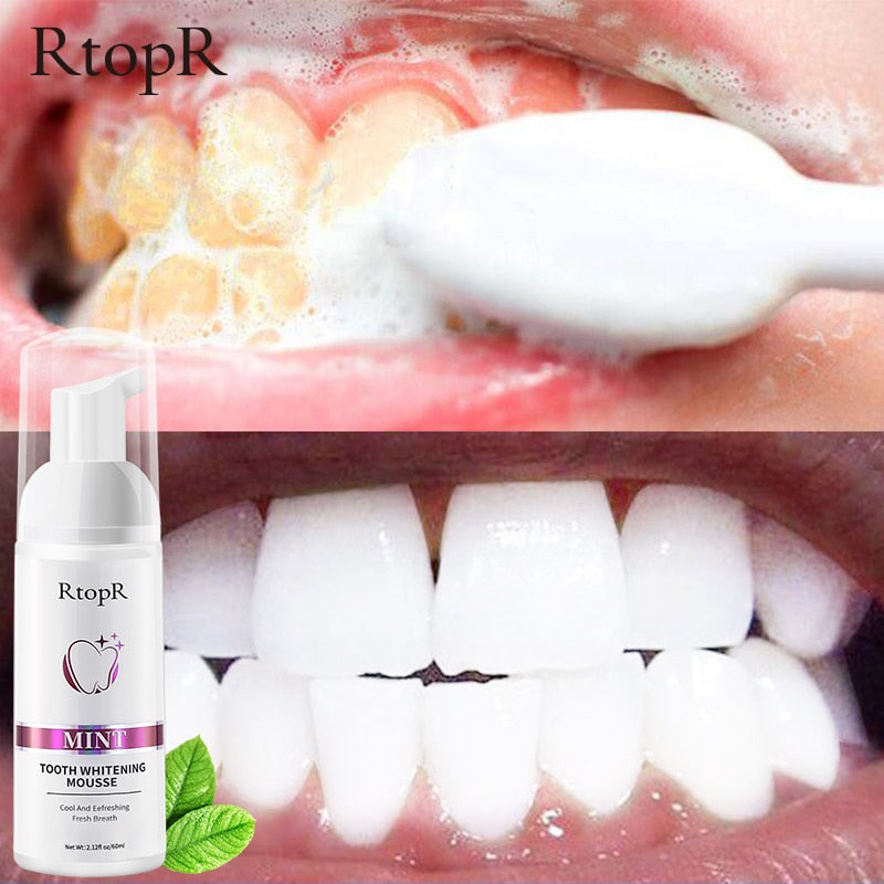 Teeth Whitening Mousse