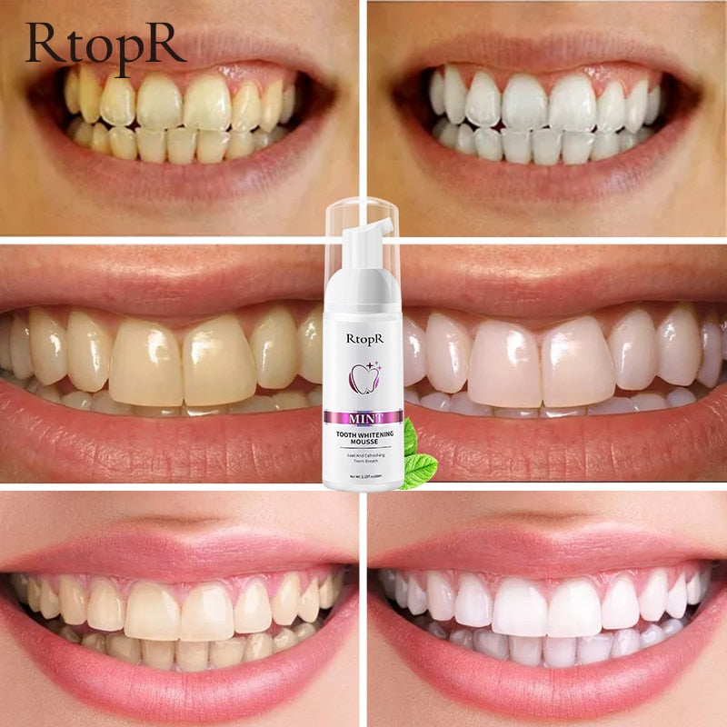 Teeth Whitening Mousse