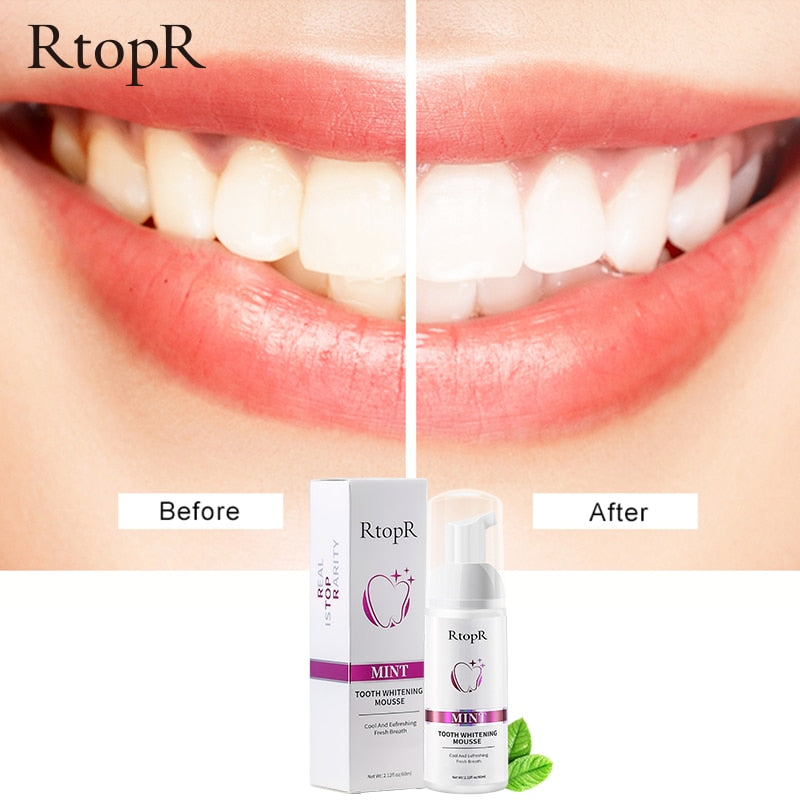 Teeth Whitening Mousse